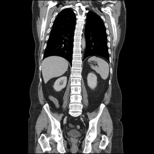 NCRG CT Scan